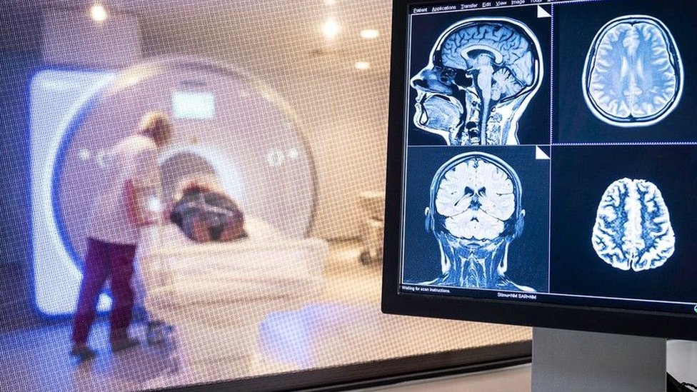 A patient undergoes a brain scan at the hospital