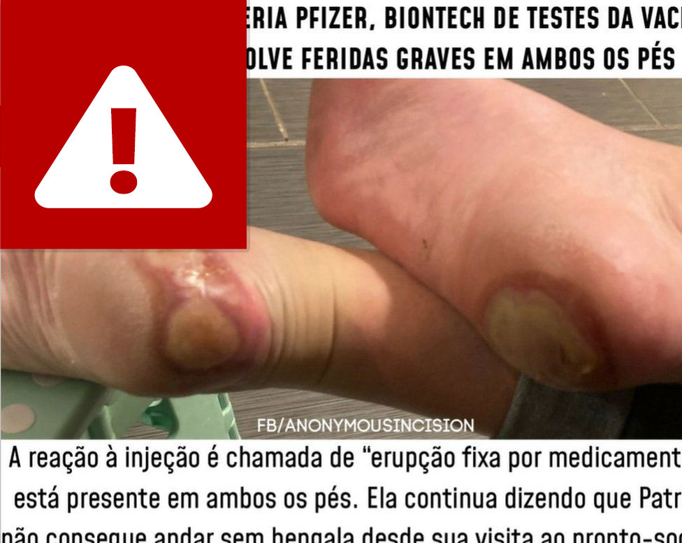 Post in Portuguese about feet